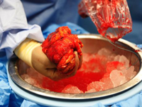 Blodigt organ som ligger i is
